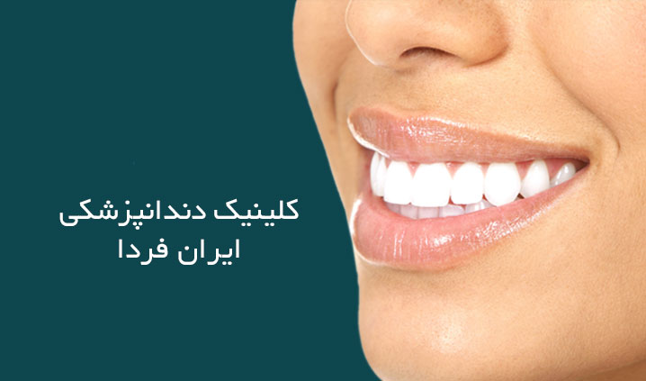 عالی ترین مرکز ایمپلنت در کرج
